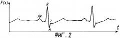 Способ измерения длительности фаз сердечного цикла и устройство для его реализации (патент 2282393)