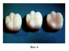 Способ контроля технологии моделирования микрорельефа окклюзионной поверхности зуба (патент 2606275)