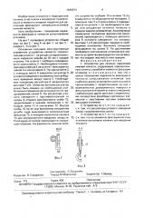 Устройство для лечения переломов нижней челюсти (патент 1635973)