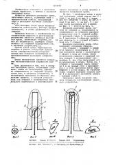 Анкерная распорная крепь (патент 1049609)