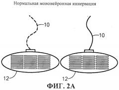 Система и способ стимуляции лицевого нерва (патент 2511082)