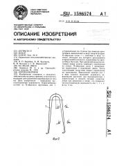 Корнезаборник (патент 1586574)