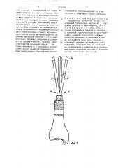 Эндопротез трубчатой кости (патент 1373402)