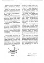 Перистальтический насос (патент 1110929)