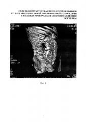 Способ контрастирования толстой кишки при проведении спиральной компьютерной томографии у больных хронической спаечной болезнью брюшины (патент 2666120)