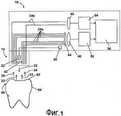 Устройство и способ выявления налета в полости рта (патент 2556568)