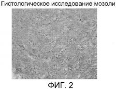 Композиционный материал для восстановления дефектов костной ткани, способ его получения и применение (патент 2476236)