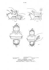Способ изготовления частичных пластиночных протезов (патент 1217399)