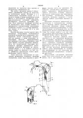 Крепление протеза руки (патент 1066588)