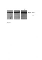 Антитела к изоформам белка oct-1 человека, рекомбинатный полипептид и способ получения антитела (патент 2590715)