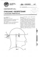 Устройство для фиксации головы (патент 1353432)