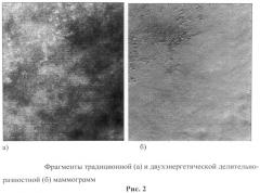 Способ двухэнергетической делительно-разностной маммографии (патент 2495623)
