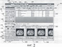 Управление сериями для менеджера архива медицинских изображений, вызывающее коренные изменения (патент 2420234)