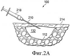 Устройство типа катетер/волокно и способы терапии ран под поверхностью кожи (патент 2468827)