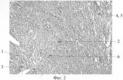 Способ моделирования очаговых повреждений миокарда (патент 2286606)