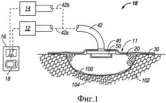 Система и способ обработки ран с использованием ультразвуковой хирургической очистки (патент 2428209)