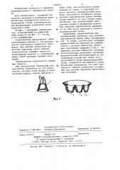 Слюноизолятор (патент 1187814)