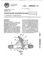 Протез клапана сердца (патент 1808320)