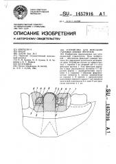 Устройство для фиксации съемных зубных протезов (патент 1457916)