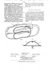 Баллон безразгрузочной крепи (патент 642484)