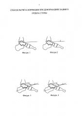 Способ расчета коррекции при деформациях заднего отдела стопы (патент 2634043)