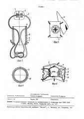 Пломба (патент 1548811)