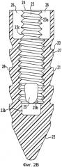 Устройство для восстановления тканей (варианты) (патент 2562601)