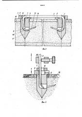 Хирургическая скобка (патент 982676)