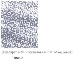 Способ оценки степени риска развития и ранней диагностики кариеса зубов (патент 2313090)