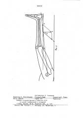 Устройство для разработки тазобедренного и коленного суставов (патент 950379)