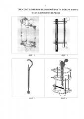 Способ удлинения бедренной кости поверх интрамедуллярного стержня (патент 2584555)