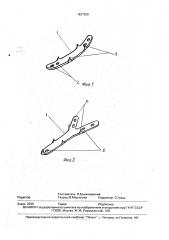 Устройство для остеосинтеза плоских костей (патент 1827209)