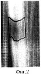 Способ оценки минерализации костного регенерата по изображениям рентгенограмм (патент 2316255)