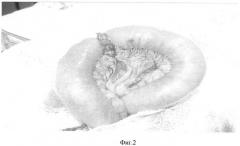Способ изучения влияния большого сальника на повышение надежности кишечного анастомоза в эксперименте (патент 2364350)