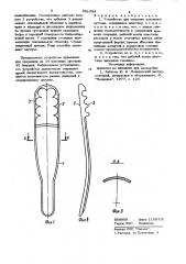 Устройство для операции коленного сустава (патент 891084)