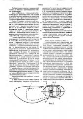 Голеностопный узел по ф.а.ткачу (патент 1593652)