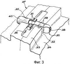 Устройство для предотвращения вращения сектора, несущего неподвижные лопатки, в корпусе газовой турбины (патент 2297539)