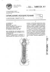 Устройство для компрессионного остеосинтеза отломков трубчатых костей (патент 1680124)