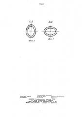 Шнековый очиститель корнеклубнеплодов от примесей (патент 1274642)