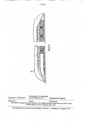 Устройство для массажа (патент 1718931)