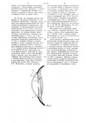 Способ имплантации интраокулярной линзы (патент 1215697)