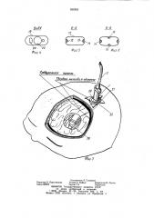Эндоскоп (патент 950303)