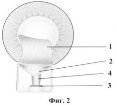 Способ комбинированного хирургического лечения глаукомы и катаракты (патент 2371149)