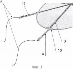 Эндопротез для бесшовной интраабдоминальной пластики при вентральных грыжах (патент 2460494)