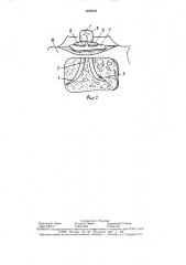 Зубной имплантат (патент 1498484)