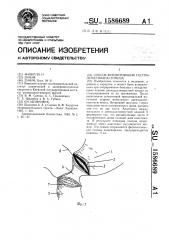 Способ формирования гастродуоденоанастомоза (патент 1586689)