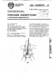 Тормозное устройство для альпинистской веревки (патент 1049070)