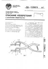 Устройство для фиксации костных фрагментов (патент 1526674)