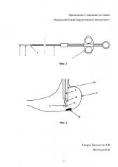 Эндоскопический хирургический инструмент (патент 2602932)