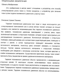 Система и способ продувки устройства пониженного давления во время лечения путем подачи пониженного давления (патент 2404822)